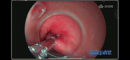 7.gif