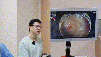 倍速活檢1.gif